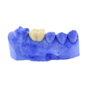 Vertex TCA (Вертекс TCA) пластмасса, цвет A3, порошок, 40 г